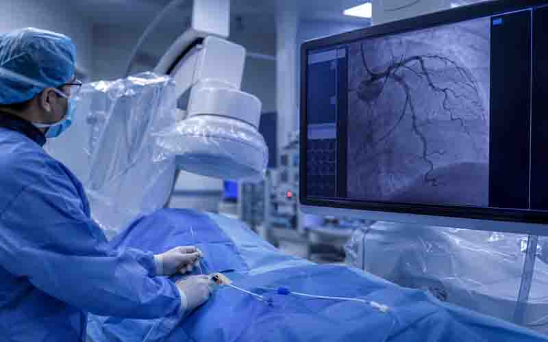 Echocardiography